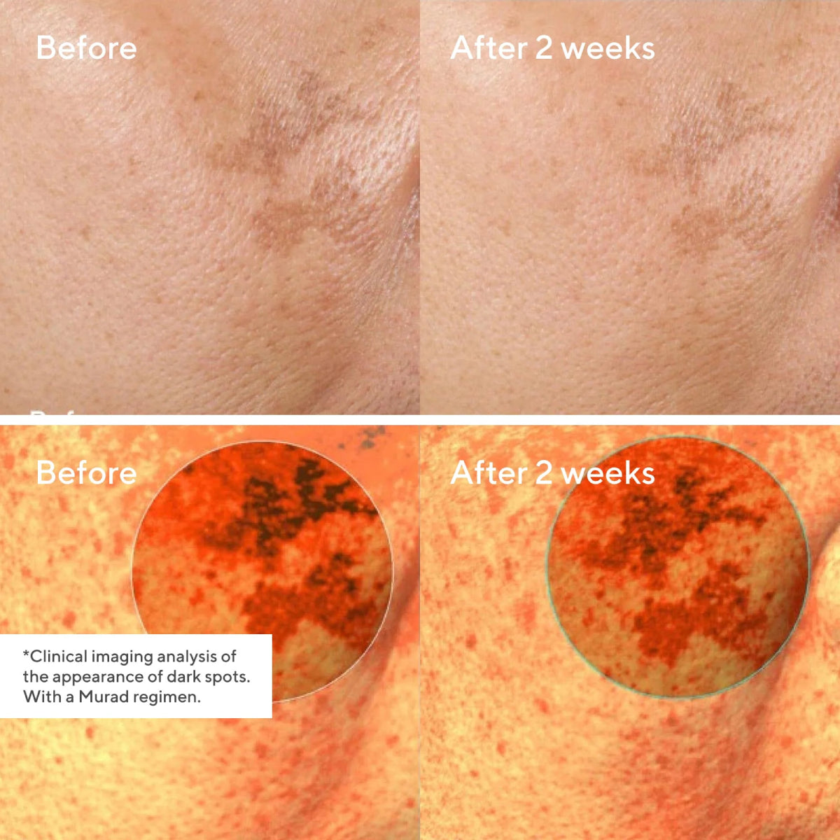 Murad Environmental Shield 1 oz Rapid Dark Spot Correcting Serum