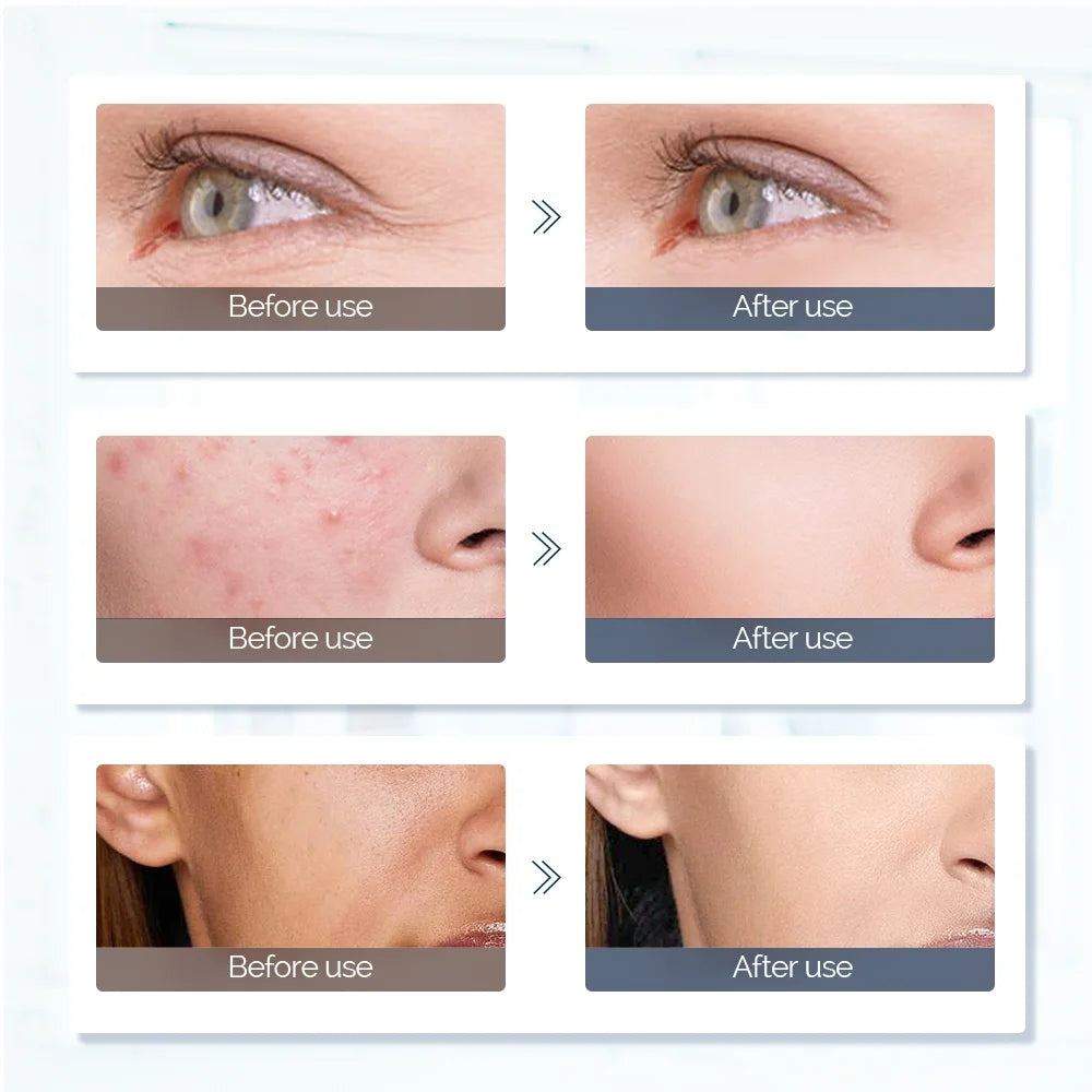 Foreverlily Face Neck LED Mask 7 Colors Photon Therapy