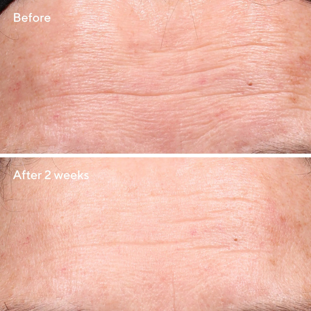 Murad 1 oz Retinol Youth Renewal Serum