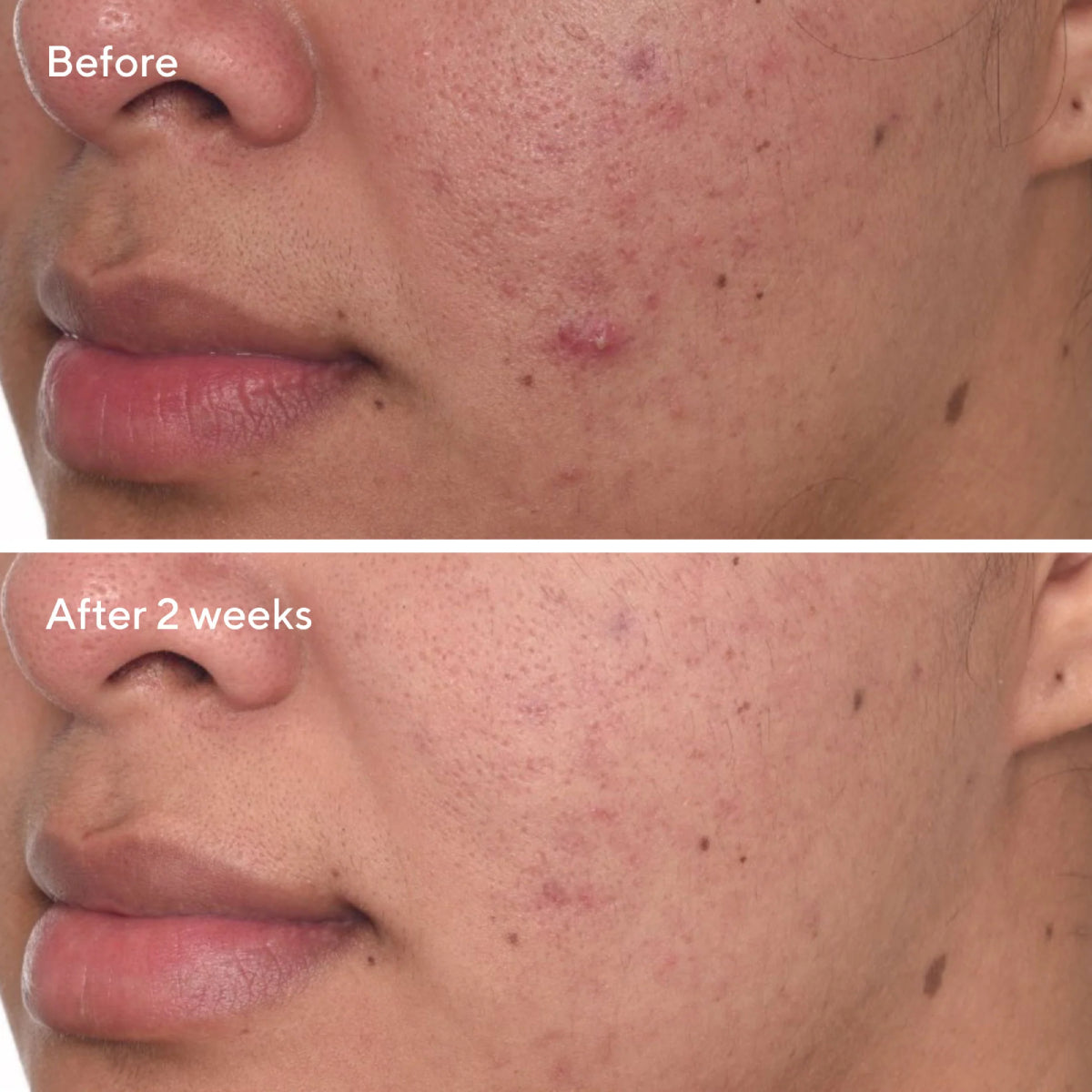 Murad Environmental Shield 1 oz Rapid Dark Spot Correcting Serum