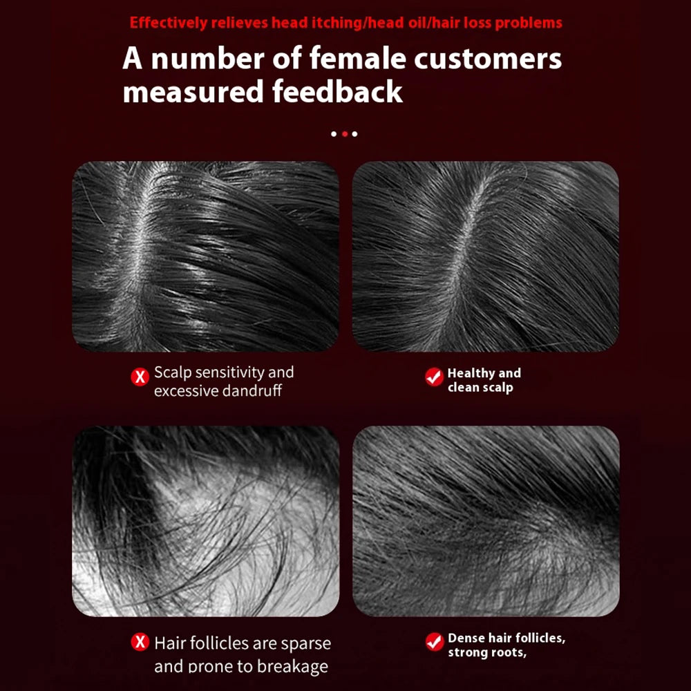 Electric Vibration Massage Comb Red Light for Hair Growth